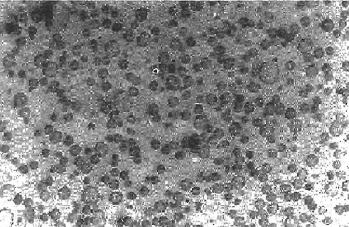 Micrografia eletrônica de um polímero vítreo contendo modificador de impacto (partículas escuras)