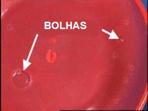 Bolhas